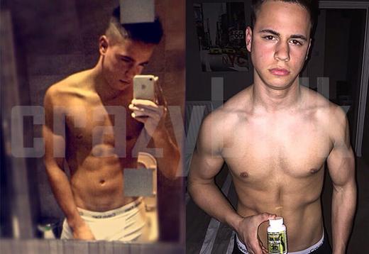 BAILY ZERSTÖRTE SEINE MÄNNERBRÜSTE MIT GYNECTROL!